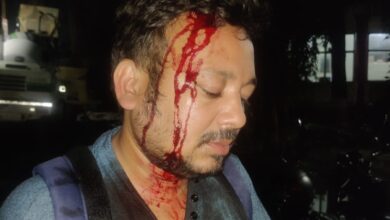 Photo of अधिवक्ता पर बीच रास्ते हमला,लूट का प्रयास,कोतवाली पुलिस को आरोपियों की तलाश।